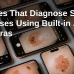 Phones That Diagnose Skin Diseases Using Built-in AI Cameras